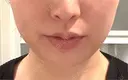 RF（高周波）たるみ治療 TUNE CLINIC【チューンクリニック】 DAY 7 サムネイル用
