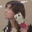 ヒアルロン酸注入（鼻） TCB東京中央美容外科 青森院 DAY 0 サムネイル用