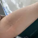 美容点滴・美容注射（疲労回復） REVO CLINIC PLUS AFTER サムネイル用