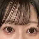 目頭切開 Brandnew Beauty Clinic DAY 194 サムネイル用