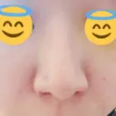 鼻孔縁挙上 / その他（鼻） シエルクリニック DAY 5 サムネイル用