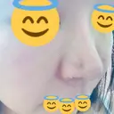 鼻孔縁挙上 / その他（鼻） シエルクリニック DAY 5 サムネイル用