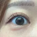 ヒアルロン酸注入（涙袋） 銀座美容外科クリニック 銀座院 AFTER サムネイル用