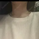 ボトックス（首） AYANAフィラーズクリニック 渋谷院 AFTER サムネイル用