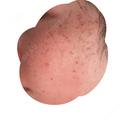 ピーリング（ハリ・ツヤ） / ルメッカ PureMe Skin Clinic（ピュアミースキンクリニック麻布） AFTER サムネイル用