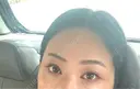 クマ治療 EMMO FACE CLINIC 東京三田院 DAY 35 サムネイル用