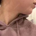 ヒアルロン酸注入（涙袋） / 脂肪溶解注射（顔） 麻布十番クレールデンタルクリニック DAY 0 サムネイル用