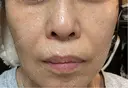 ショッピングリフト Natural Skin Clinic 笹塚院 DAY 2 サムネイル用