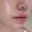 ヒアルロン酸注入（あご） / ヒアルロン酸注入（唇） / ボトックス（口角） ルラ美容クリニック 大阪本院 DAY 0 サムネイル用