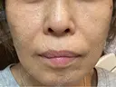 ショッピングリフト Natural Skin Clinic 笹塚院 DAY 3 サムネイル用