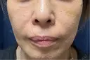 ショッピングリフト Natural Skin Clinic 笹塚院 DAY 7 サムネイル用