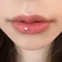 ヒアルロン酸注入（唇） AZ BEAUTY CLINIC DAY 1 サムネイル用