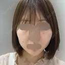 RF（高周波）たるみ治療 ルラ美容クリニック 福岡本院 DAY 3 サムネイル用