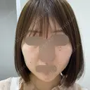 RF（高周波）たるみ治療 ルラ美容クリニック 福岡本院 DAY 7 サムネイル用