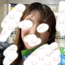 ヒアルロン酸注入（鼻） TCB東京中央美容外科 青森院 DAY 14 サムネイル用