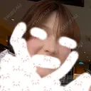 ヒアルロン酸注入（鼻） TCB東京中央美容外科 青森院 DAY 6 サムネイル用