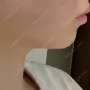 RF（高周波）たるみ治療 CIEL SKIN CLINIC（シエルスキンクリニック） DAY 56 サムネイル用