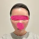 糸リフト / ヒアルロン酸注入（頬） EMMO FACE CLINIC 東京三田院 DAY 0 サムネイル用