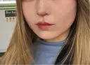 ボトックス（エラ・小顔） AYANAフィラーズクリニック 渋谷院 DAY 1 サムネイル用