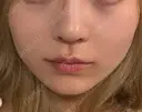 ボトックス（エラ・小顔） AYANAフィラーズクリニック 渋谷院 DAY 16 サムネイル用