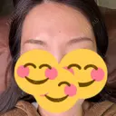 アートメイク（眉） BMC CLINIC 南青山 AFTER サムネイル用