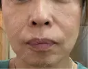 ショッピングリフト Natural Skin Clinic 笹塚院 DAY 21 サムネイル用