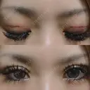 二重埋没 かめい美容クリニック宇都宮 DAY 1 サムネイル用
