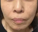 ショッピングリフト Natural Skin Clinic 笹塚院 DAY 28 サムネイル用