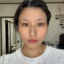 ボトックス（エラ・小顔） / ボトックス（肩） DMTC美容皮膚科 大宮院 DAY 0 サムネイル用