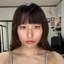 ボトックス（エラ・小顔） / ボトックス（肩） DMTC美容皮膚科 大宮院 DAY 0 サムネイル用