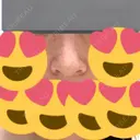 小鼻縮小（切開） アネシス美容クリニック AFTER サムネイル用