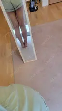 脂肪吸引（脚） アムルーズ美容外科クリニック 横浜院 DAY 123 サムネイル用