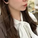 ボトックス（エラ・小顔） / ボトックス（肩） フォンタナクリニック天神 DAY 16 サムネイル用
