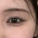 二重埋没 ROOTS Clinic DAY 7 サムネイル用