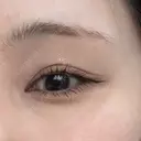 二重埋没 ROOTS Clinic AFTER サムネイル用