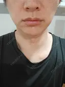 ルメッカ ルラ美容クリニック 名古屋本院 AFTER サムネイル用