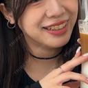 肌ヒアルロン酸注入（たるみ・シワ改善） / ヒアルロン酸注入（頬） LIBER CLINIC DAY 2 サムネイル用