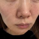 スネコス 仙台TAクリニック DAY 1 サムネイル用