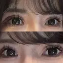 二重切開 / 眼瞼下垂（切開） / その他（目元） / 目尻切開 / タレ目形成・グラマラスライン（切開） オーキッド美容クリニック東京御徒町 DAY 56 サムネイル用