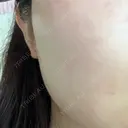 ルメッカ ルラ美容クリニック 京都院 DAY 0 サムネイル用