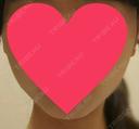 ハイフ（顔） 赤坂プレミアクリニック DAY 16 サムネイル用