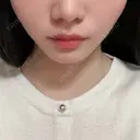 その他（輪郭） ルラ美容クリニック 沖縄院 AFTER サムネイル用