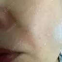 ショッピングリフト BAO CLINIC 梅田院 DAY 2 サムネイル用