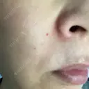 ショッピングリフト BAO CLINIC 梅田院 DAY 2 サムネイル用