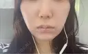 脂肪溶解注射（顔） Nクリニック伏見 DAY 6 サムネイル用
