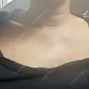 白玉点滴・注射 TCB東京中央美容外科 浜松院 DAY 23 サムネイル用