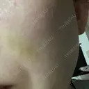 ショッピングリフト BAO CLINIC 梅田院 DAY 5 サムネイル用