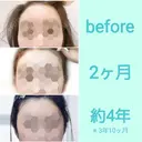 額を丸く クリニックビューティー恵比寿 DAY 1395 サムネイル用