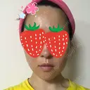 ボトックス（エラ・小顔） 湘南美容クリニック 京都院 DAY 4 サムネイル用