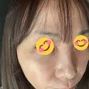 肌育注射（ジュベルックなど） / その他（肌） ゆきスキンクリニック 東池袋 DAY 2 サムネイル用